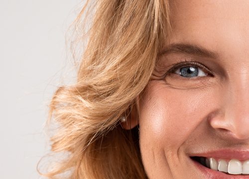 Photo of a woman with crow's feet wrinkles around her eyes