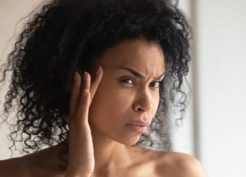 Photo of a woman with frown lines between her brow