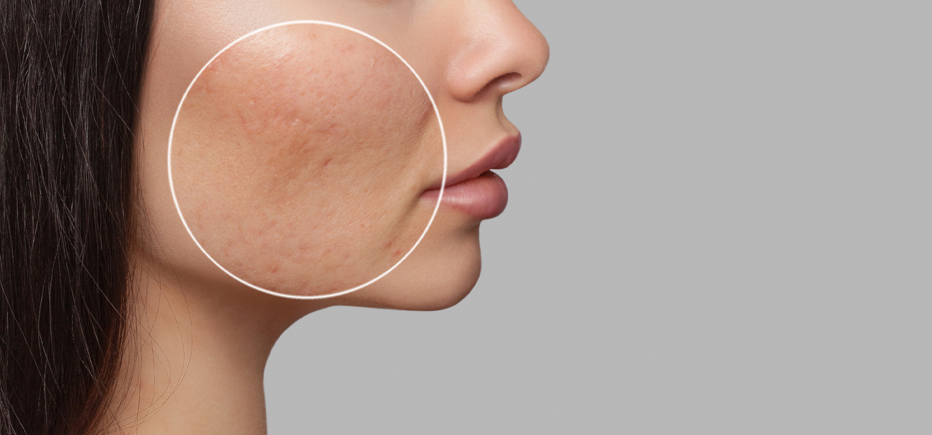 Large Pores