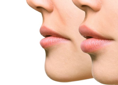 Photo of a two women side by side with focus on their lips
