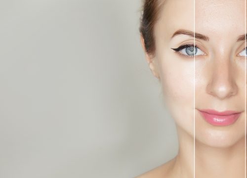 Photo of a woman with an uneven skin tone