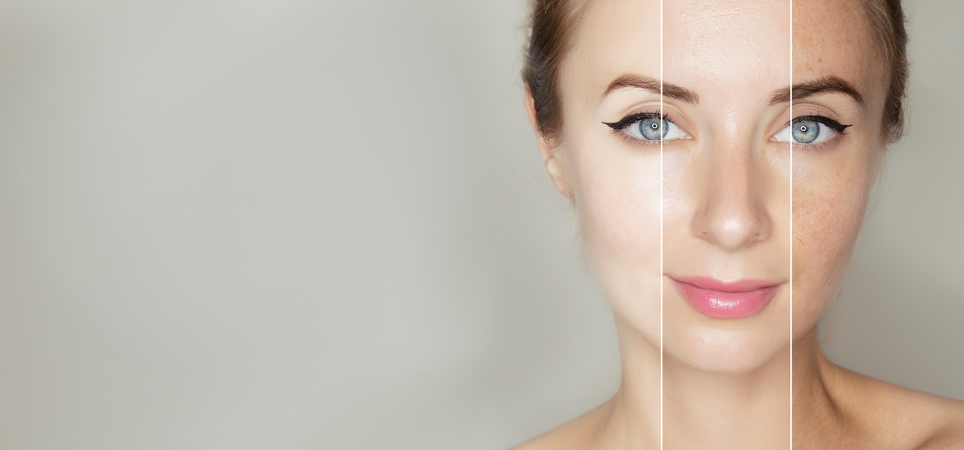 Uneven skin clearance tone