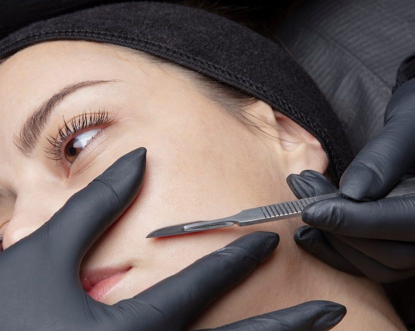 Woman receiving a dermaplaning treatment