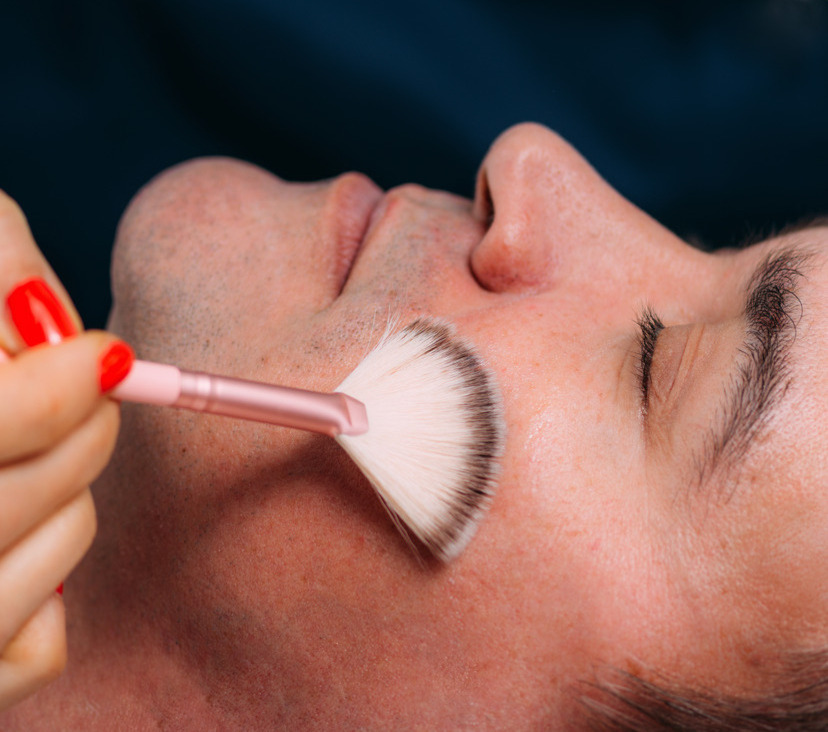 Photo of a man receiving a chemical peel