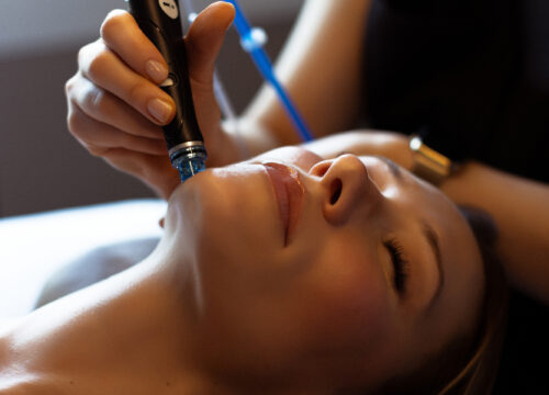 Photo of a Hydrafacial treatment at Captivate