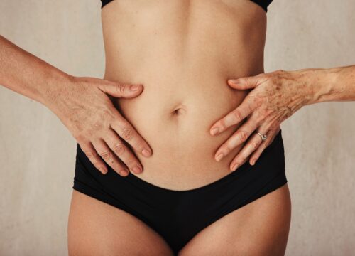 Photo of a woman's flat, tight stomach after Venus Octipolar skin tightening treatments
