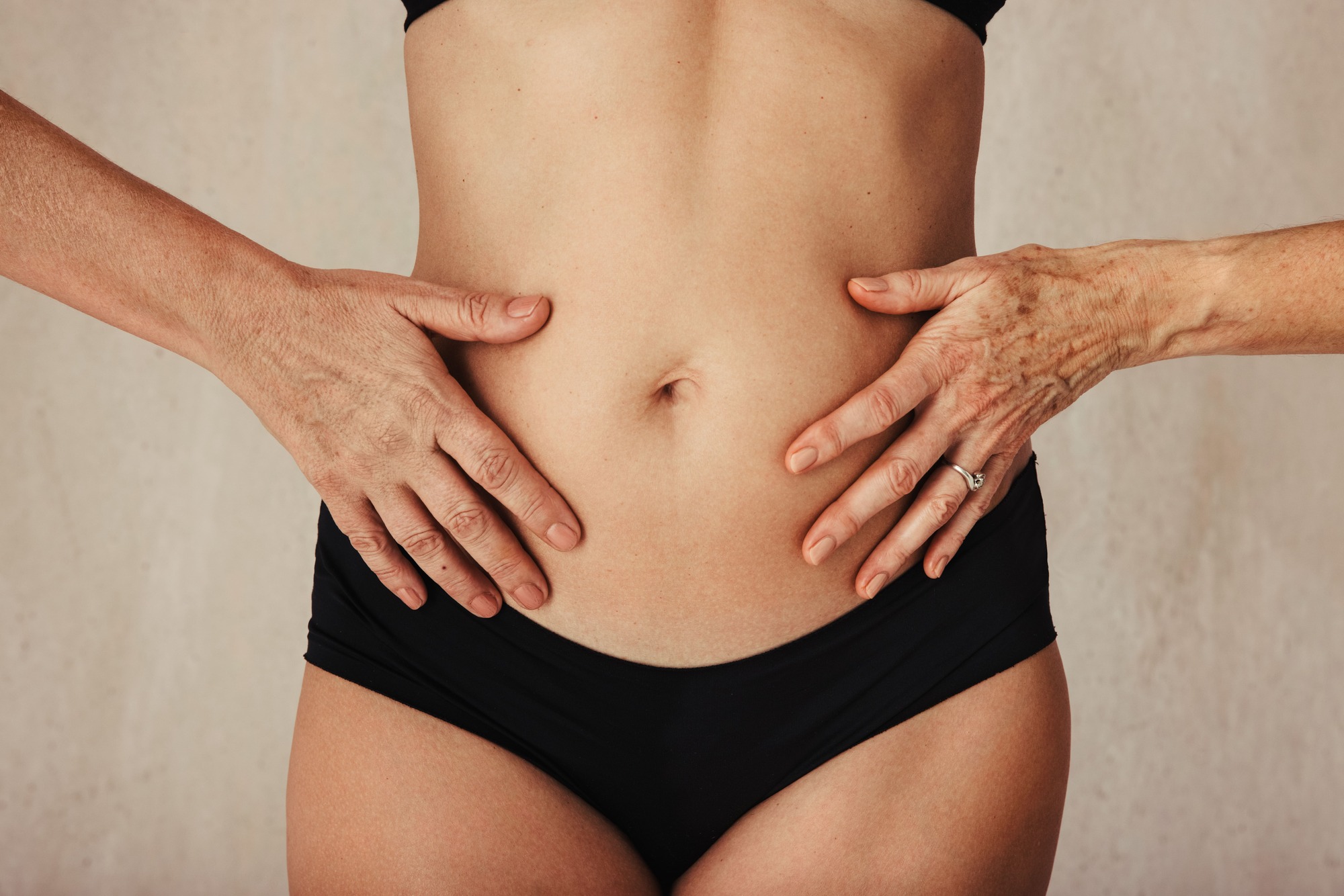 Venus Octipolar Skin Tightening