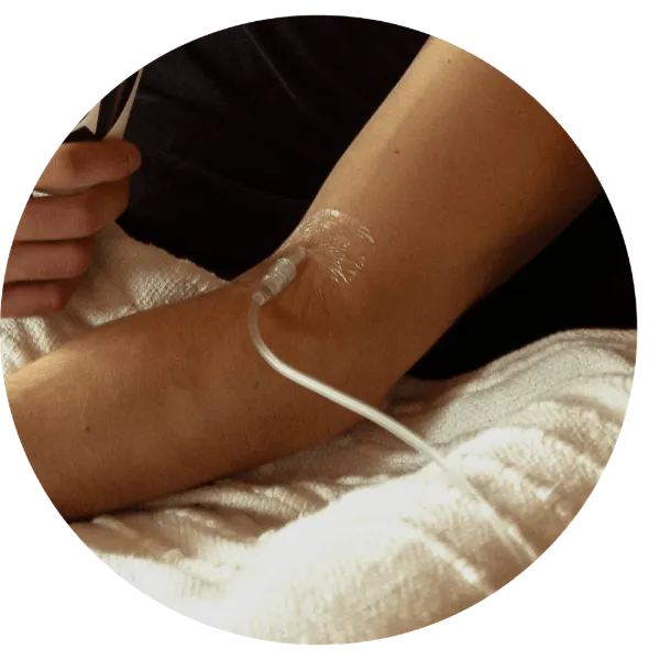 Mobile IV therapy